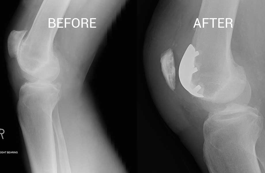 Dr Sunil Kini Specialist Hip and Knee Surgeon